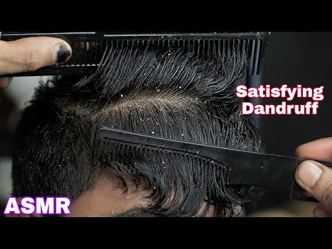 Dandruff Scratching and Dandruff Treatment ASMR for best relaxation
