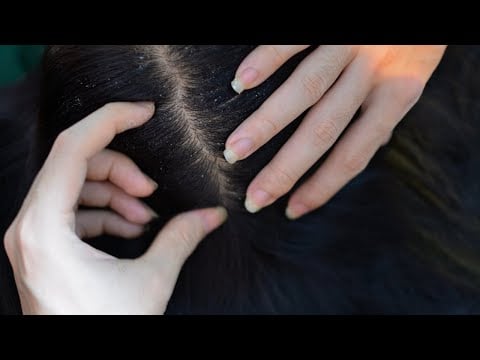 ASMR Scalp Check, Scalp Scratching Tingling For Rest And Sleep ( No Talking Asmr )