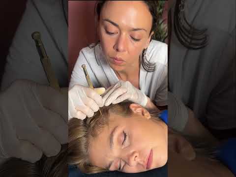 Asmr scalp tingles #asmr #asmrsounds #asmrvideo #relax #relaxing #satisfying #hair #sleep #tingles