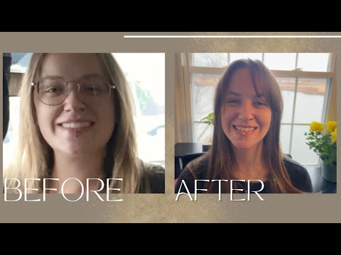 ASMR Extended Scalp Exam, Trichology Treatment & Haircut | Real Personal Attention