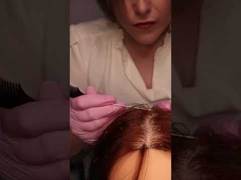 ASMR Scalp Check & Dandruff Removal: Satisfyingly GOOD! #asmr #asmrscalpcheck #asmrvideo