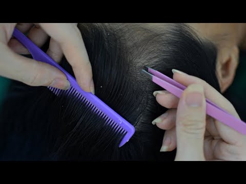 ASMR Scalp Check ~ Scalp Picking ~ Plucking Frey Hair For Deep Sleep ( No Talking )