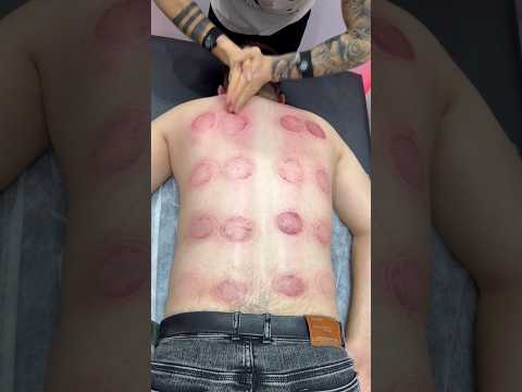 #shortsviral #shorts #explore #fyp #viral #youtubeshorts #asmrsounds #asmr #cupping
