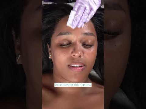 ASMR SkinBetter Peel