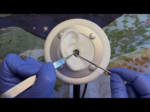 Perforated Eardrum Surgery | Visual ASMR | Microchip Series Part 3