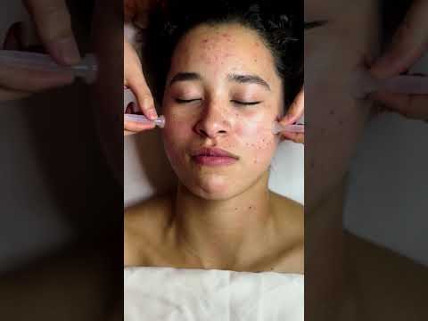 Jaw melting massage #asmr