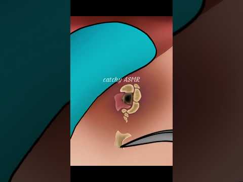 Satisfying lip piercing cleaning animation, Relaxing ASMR animation, ASMR animation