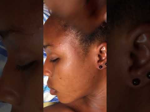 ASMR BEST FACE NITPICKING AND TOUCHING #asmr #satisfying #nitpicking #relaxing