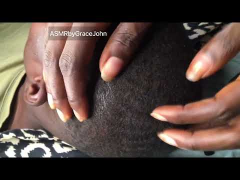 Asmr Dandruff Scratching | Very Dry Scalp |Flakes #scratch #scalpscratching #asmr