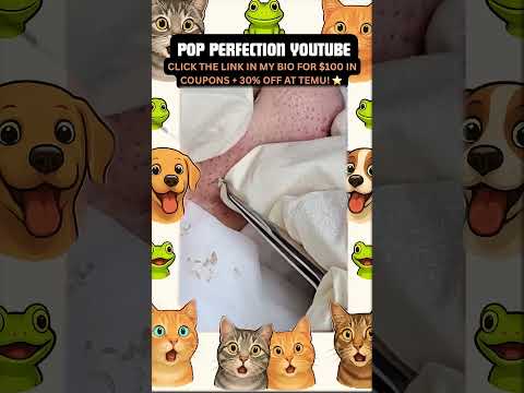 Wow! #pimpleremoval #pimple #pimples #shortsfeed #shortvideo #shorts #short #youtube #youtubeshorts