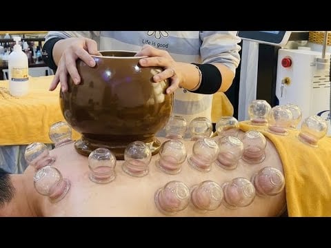ASMR 🇻🇳 Extra-large cup fire cupping therapy | Deep relaxation | No talking