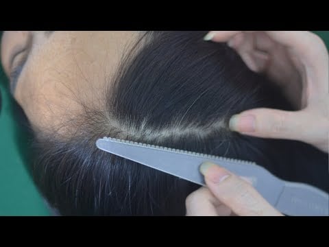 ASMR Aggressive Scalp Scratching Massage With Hair Sounds, No Talking For Relieve Stress