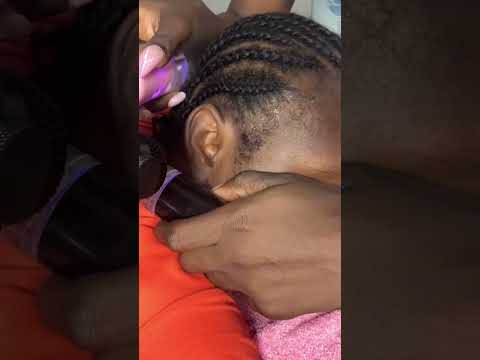 ASMR Relaxing Ear Cleaning and Picking for Those Who Need Sleep Immediately, with Gum and Whispers