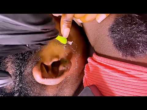 ASMR  ear cleaning, Head & Neck Massage Ear piercing nitpicking Scalp Picking, Armpit & Eyebrow 