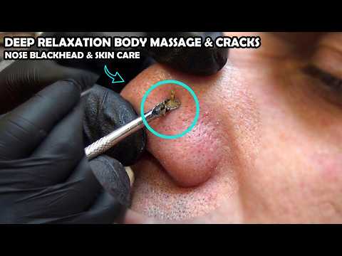💈 ASMR BARBER BLACKHEADS REMOVAL & SKIN CARE + CRACKS + head,face,chest,armpit,back & body massage