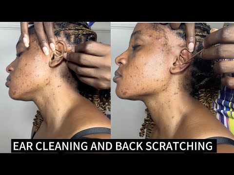 ASMR Ear Cleaning, Back Scratching, Ear Scratching & Nitpicking for Deep Sleep |  Relaxing Sounds