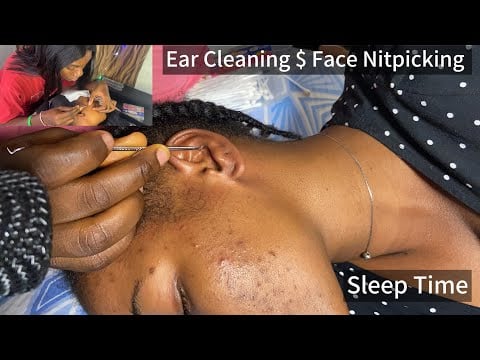 ASMR COME LET ME PUT YOU TO SLEEP WITH THIS EAR CLEANING AND FACE NITPICKING PART 2