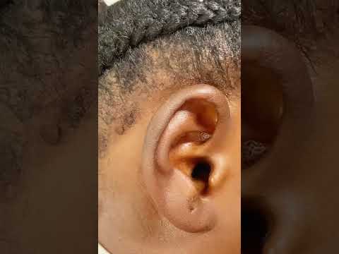 ASMR A REAL PERSON GENTLE NITPICKING 👂 #asmr #relax #satisfying #tingling