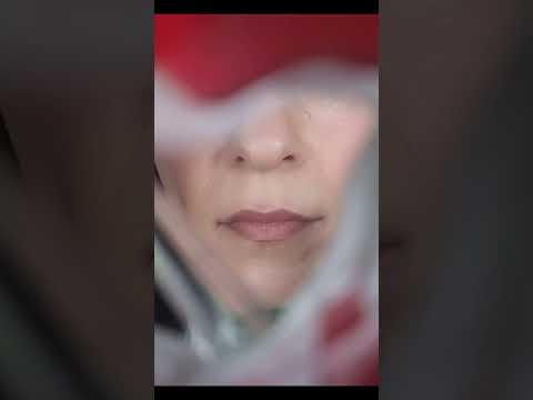 heart surgery | full video: https://youtu.be/uBYZgS99ZbQ?feature=shared