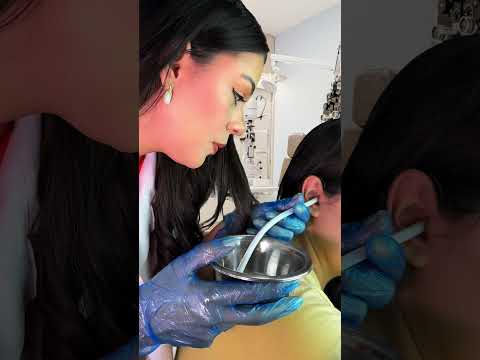 POV: limpeza de pele realista #asmr #humor #shorts