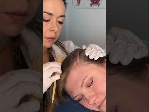 Asmr scalp 💆🏻‍♀️ #asmr #asmrsounds #asmrvideo #relax #relaxing #satisfying #hair #tingles