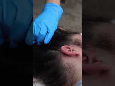 ASMR Real Person Scalp Sensation Sharp Dull Testing | unintentional medical asmr