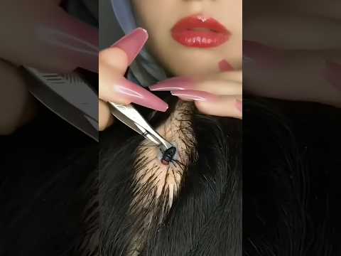 Scalp Check 💆🏻‍♀️ #asmr #satisfying #shorts #asmrmassage #relax #asmrscratching #tingles