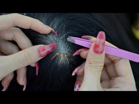 ASMR Scalp Check, Scalp Picking With Tweezers For Relaxation ( No Talking
