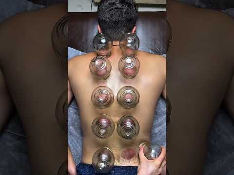 asmr cupping #shorts
