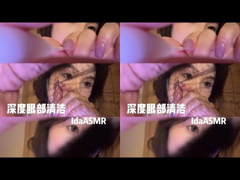 【Ida Sleep Aid】 Deep Eye Cleaning #ASMR# Sleep Aid#Eye Cleaning#Focus#Focus Training