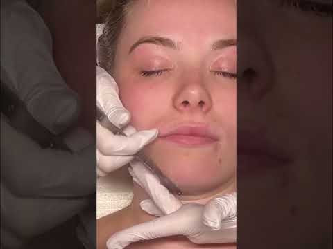 Extreme Facial Scraping: What They Remove From Your Skin! #shorts