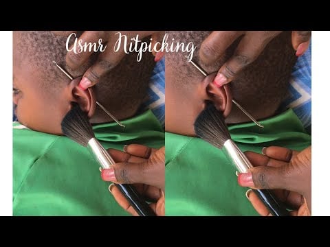 Face Nitpicking On My Baby Asmr -With the sound of rain. #asmrsounds #asmreating #nitpicking