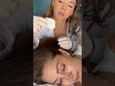 Asmr scalp tingles #asmr #asmrsounds #asmrvideo #relax #relaxing #satisfying #hair #sleep #tingles