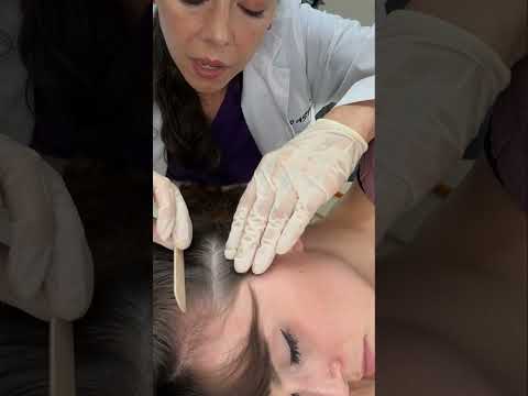 Asmr scalp tingles #asmr #asmrsounds #asmrvideo #relax #relaxing #satisfying #hair #sleep #tingles