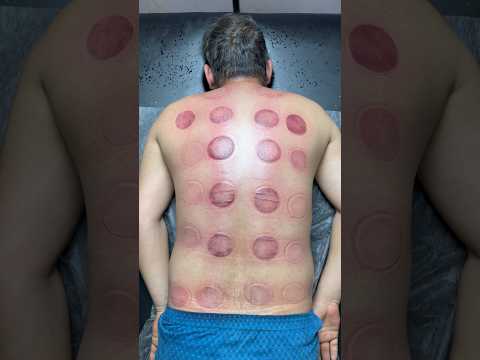 asmr wow cupping😍🔥#shorts #youtubeshorts #asmr #viral #trending