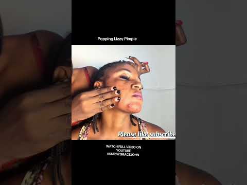 Pimple Popping and ear cleaning for sleep and relaxation #asmr
