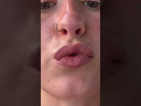 #kiss