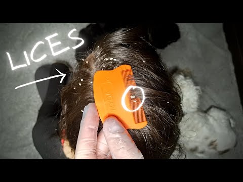 ASMR Lice removal, NO-Talking! Real person ASMR, Scalp Check / Lice Check. 💆