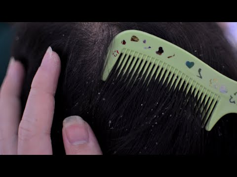 ASMR Relaxing Scalp Check - Scalp Scratching - Combing For Sleep