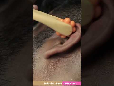 Satisfying Forehead Massage With New Tool And Crunchy Neck Cracking ASMR #shorts