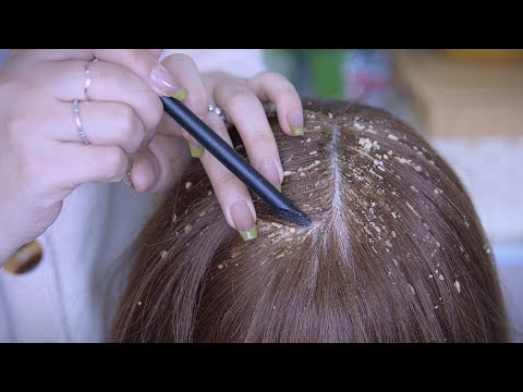 Dandruff Removal with Herbal Materials  | Satisfying ASMR
