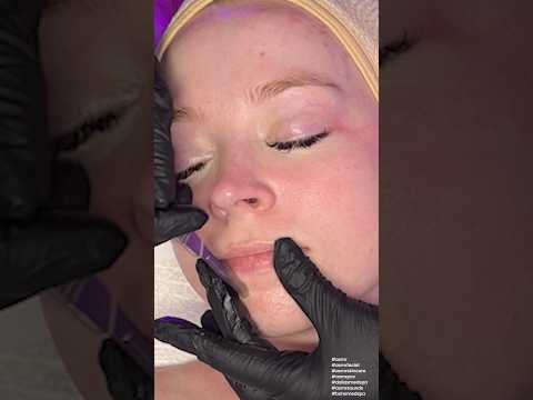 ASMR Dermaplaning on Kaylee Dudley