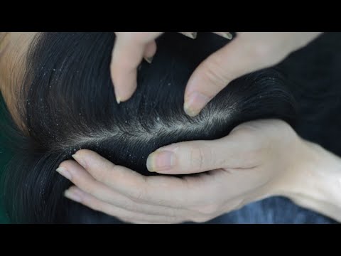 ASMR Scalp Check With Tweezers, Scalp Picking, Hair Plucking For Relieve Stress, Sleep