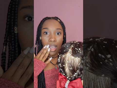 AMIGA, QUE TANTA CASPA É ESSA NO SEU CABELO 💇‍♀️ #asmr #shorts #shortsvideo #asmrbrasil
