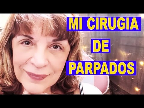 MI CIRUGIA DE PARPADOS [BLEFAROPLASTIA] LO QUE NADIE TE CUENTA