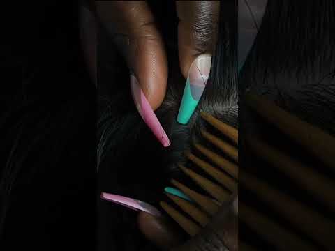 ATTENTIVELY NITPICKING whiteheads with long nails | FULL VIDEO ON OUR YOUTUBE #shortsvideo #shorts