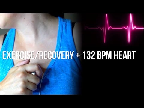 Visible Female Heartbeat After Exercise & Squats With Recovery Heartbeat
