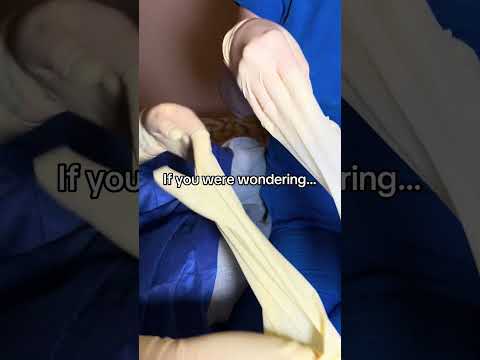 Taking off 3 pairs of gloves after a long procedure #medicalexam #nurse #surgicalgloves