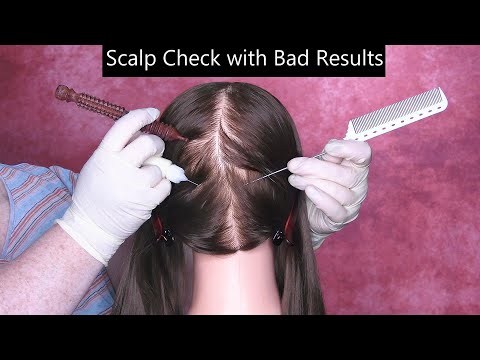 ASMR Scalp Check with Bad Results (Scalp Treatment, Scalp Exfoliation, Scalp Scratching, Whispering)