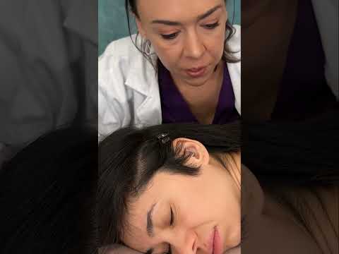 Asmr scalp tingles #asmr #asmrsounds #asmrvideo #relax #relaxing #satisfying #hair #sleep #tingles